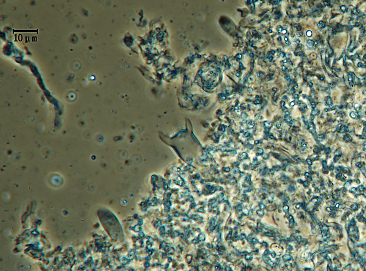 Vuilleminia 2 (Vuilleminia comedens)